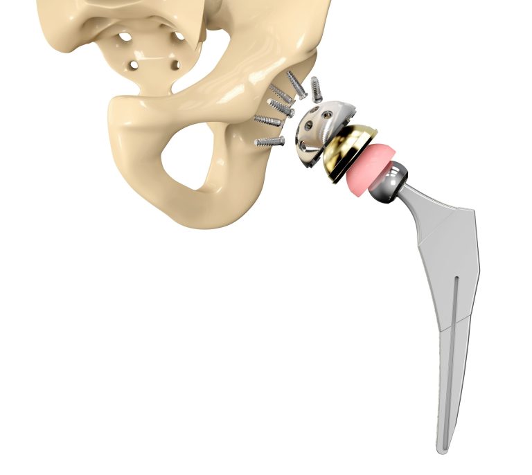 Orthopaedics