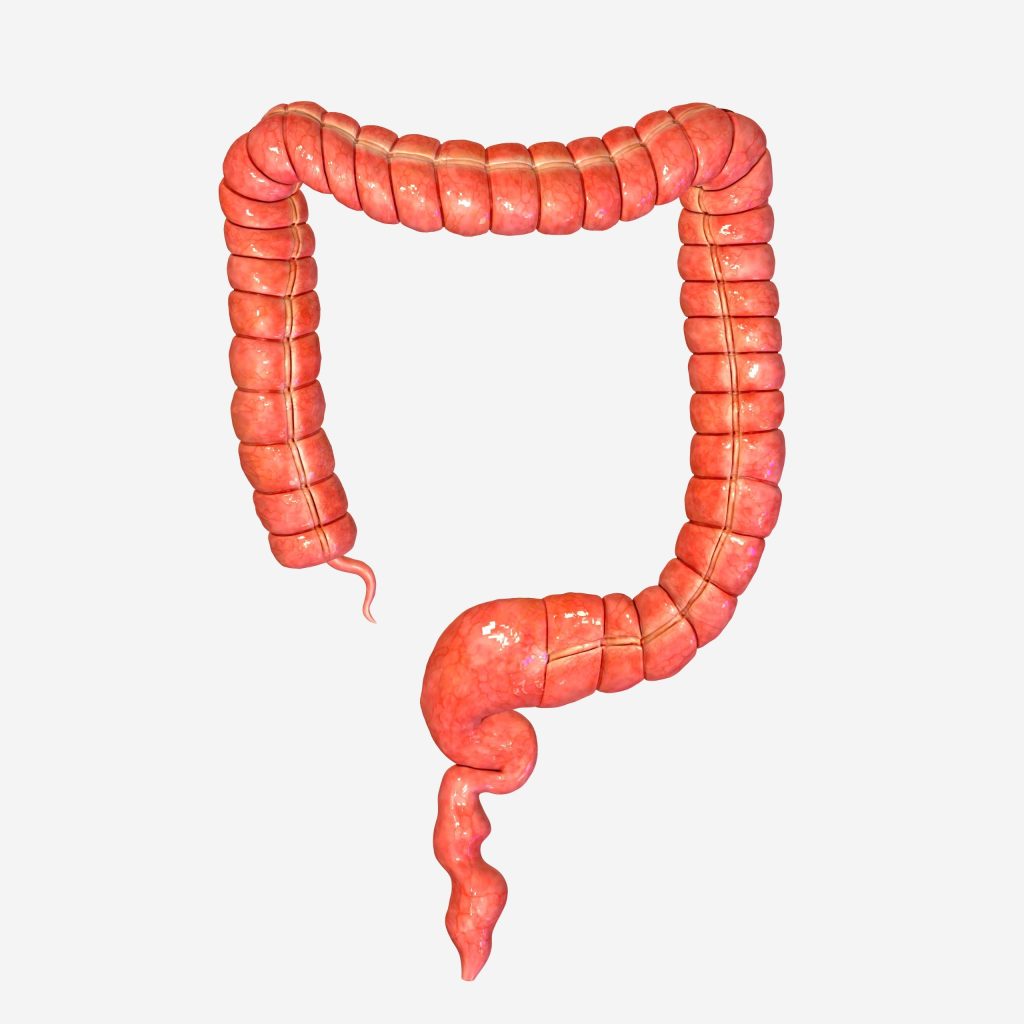 Colorectal
